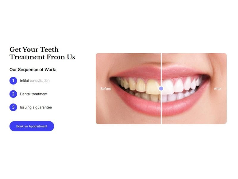 Before After Widget for Teeth Treatment